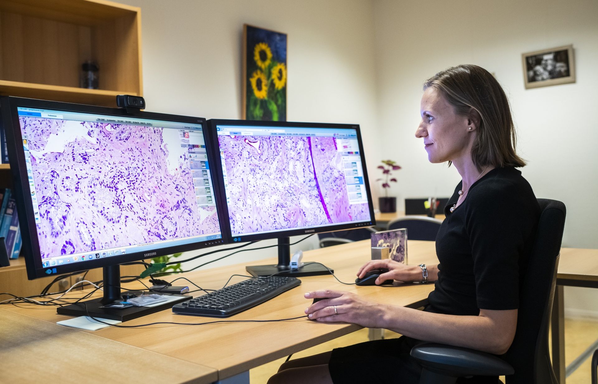 Patholoog kijkt naar microscopische beelden