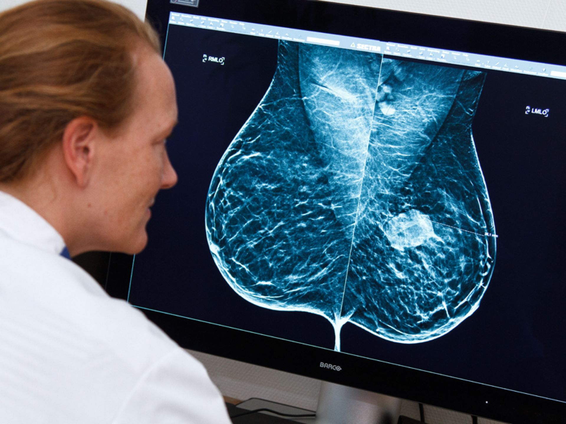 Zorgprofessional analyseert de scan van een borst